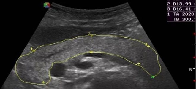 фото1 поджелудочная железа гормоны