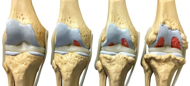 фото1 применение амбене