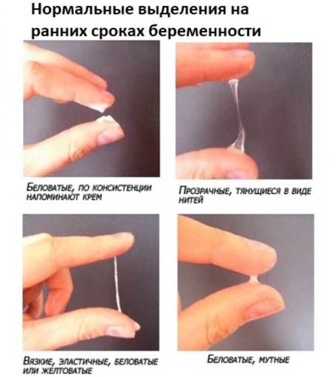 признаки беременности выделения признаки беременности выделения
