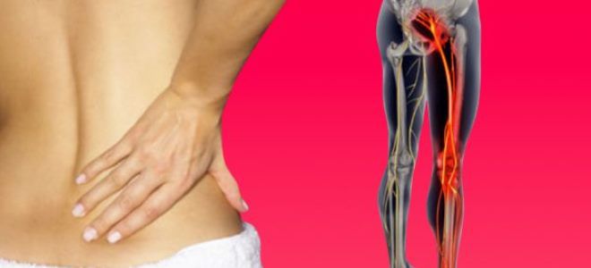 воспаление седалищного нерва симптомы воспаление седалищного нерва симптомы