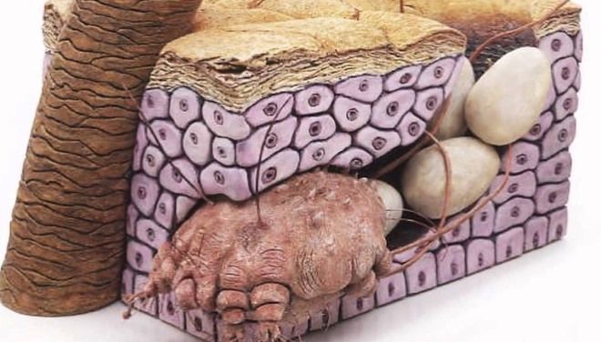 возбудитель чесотки возбудитель чесотки