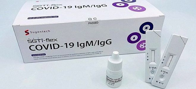 анализ на иммуноглобулин м анализ на иммуноглобулин м