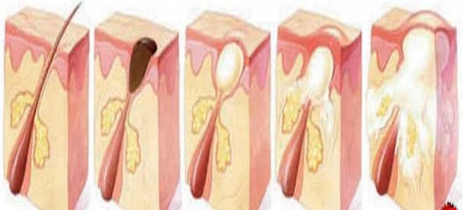 фото2 чири на лице