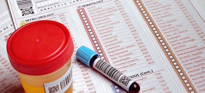 диагностика сахарного диабета 1 типа диагностика сахарного диабета 1 типа