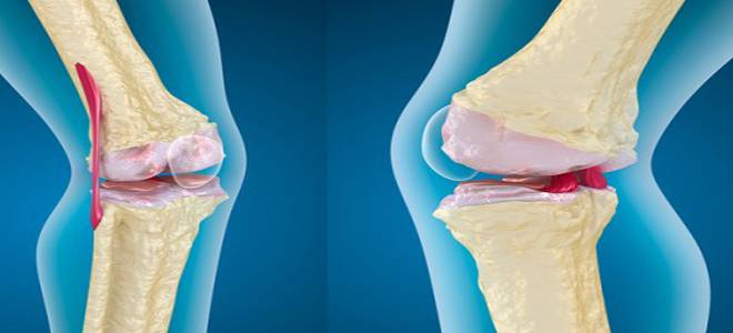 фото2 драстоп в уколах