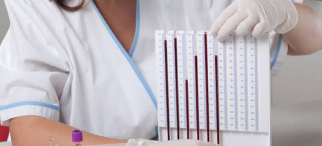 как сдавать кровь на соэ как сдавать кровь на соэ