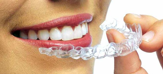 капы для отбеливания зубов капы для отбеливания зубов