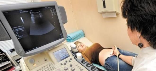 киста на яичниках у женщин киста на яичниках у женщин