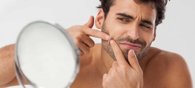 когда проходят прыщи у мальчиков когда проходят прыщи у мальчиков