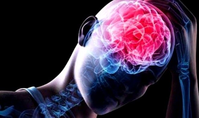 контузия головного мозга контузия головного мозга