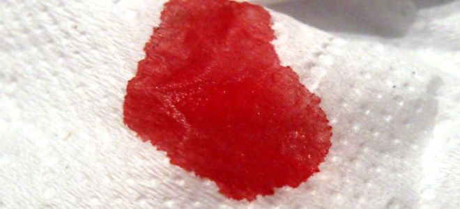 кровь в стуле кровь в стуле