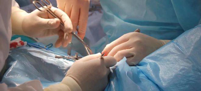 липома на шее удаление липома на шее удаление