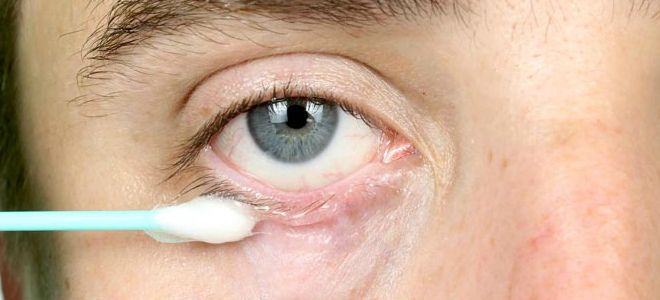 мазь Гидрокортизон в офтальмологии мазь Гидрокортизон в офтальмологии