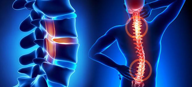 ортопед вертебролог ортопед вертебролог