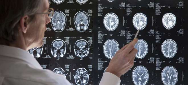 Отек мозга при аллергии Отек мозга при аллергии