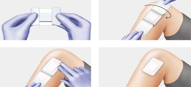 пластырь cosmopor пластырь cosmopor