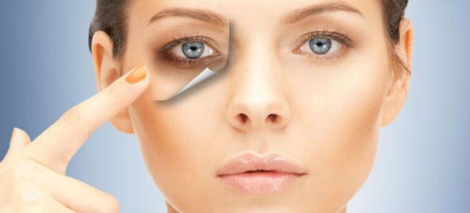 почему появляются мешки под глазами почему появляются мешки под глазами