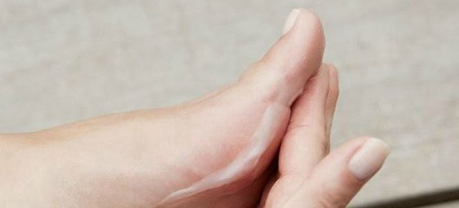 противогрибковые препараты применение противогрибковые препараты применение