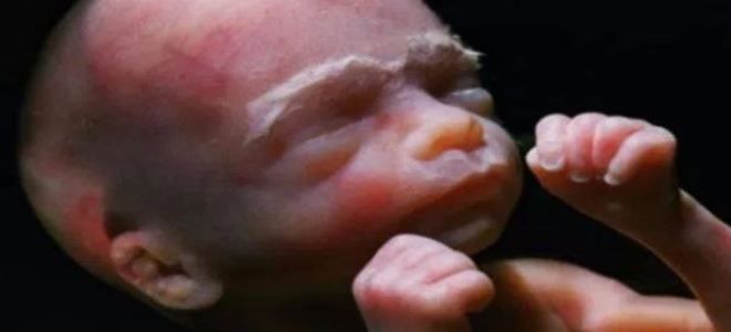 узи 22 недели узи 22 недели