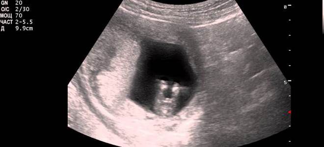 узи в первом триместре беременности узи в первом триместре беременности