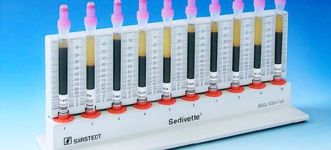 анализ соэ анализ соэ