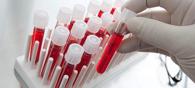 анализы на лямблии у детей анализы на лямблии у детей