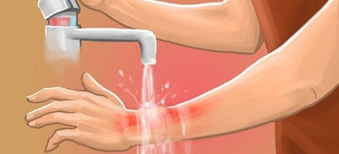 что делать при термическом ожоге что делать при термическом ожоге