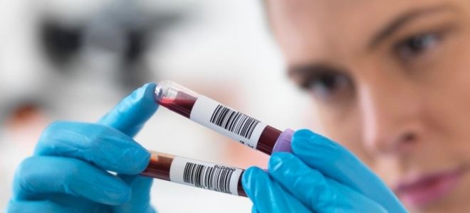 фсг норма у женщин фсг норма у женщин