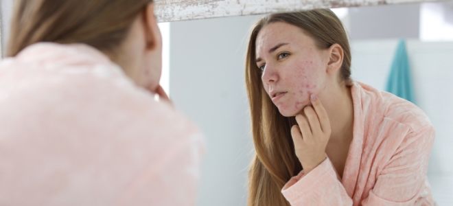 как лечить аллергию на шерсть как лечить аллергию на шерсть