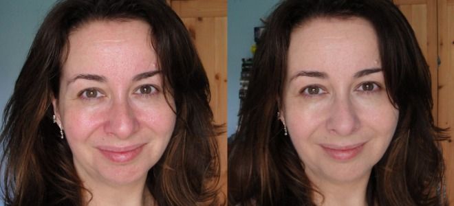 Крахмально желатиновая маска для лица до после раз Крахмально желатиновая маска для лица до после раз