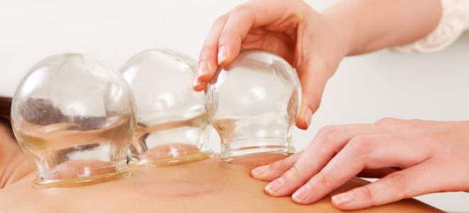 лечение остеохондроза банками лечение остеохондроза банками