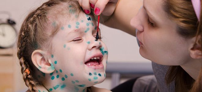 может ли ветрянка передаться через здорового человека может ли ветрянка передаться через здорового человека