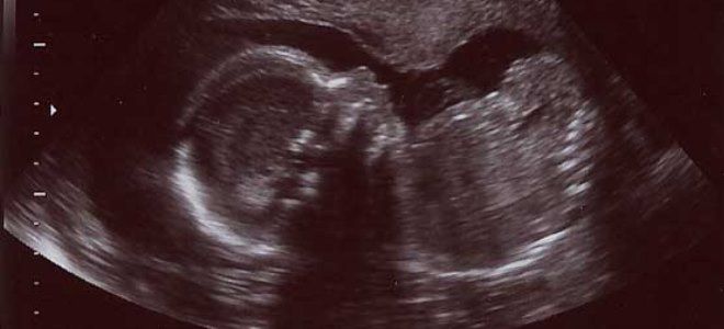 плод на 22 неделе плод на 22 неделе