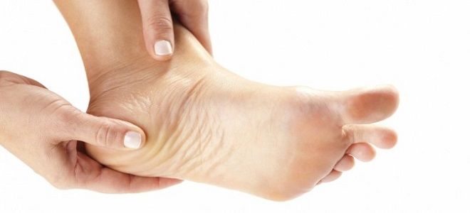 фото3 пяточная шпора это