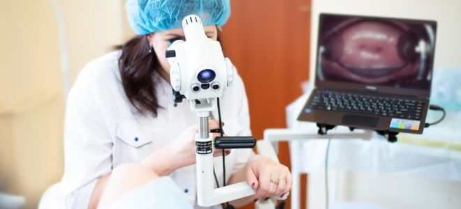 результаты кольпоскопии результаты кольпоскопии