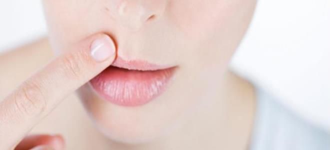 стелланин от герпеса стелланин от герпеса