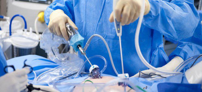 удаление миомы матки удаление миомы матки