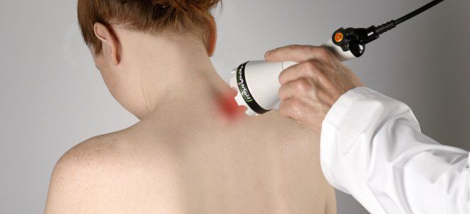 физиотерапия при остеохондрозе физиотерапия при остеохондрозе