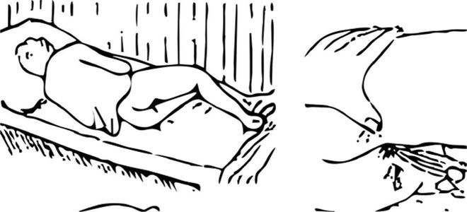 Измерение температуры ректально Измерение температуры ректально