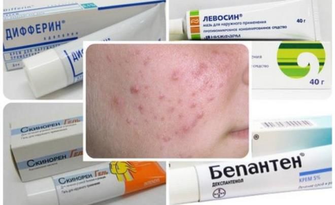 крем от прыщей для подростков крем от прыщей для подростков