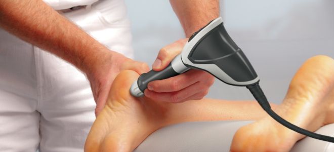 фото4 пяточная шпора на пятке