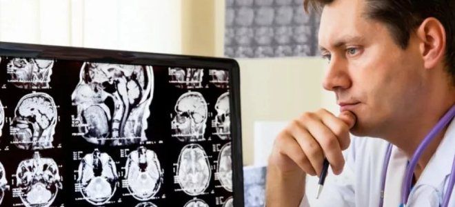 рассеянный склероз диагностика рассеянный склероз диагностика