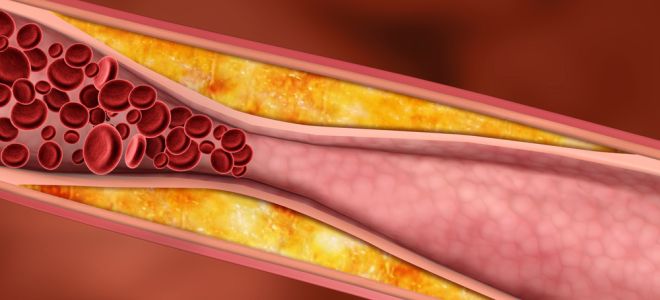 цветы липы от холестерина цветы липы от холестерина