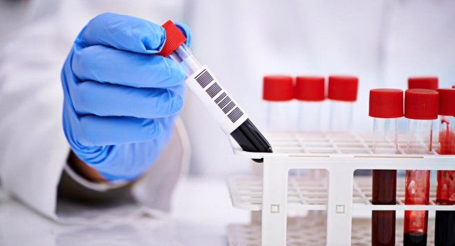 диагностика контузии диагностика контузии