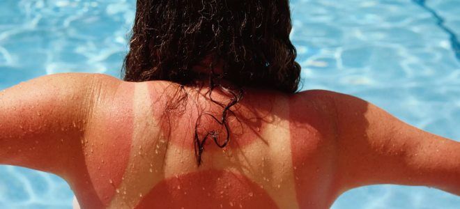 как лечить химический ожог в домашних условиях как лечить химический ожог в домашних условиях