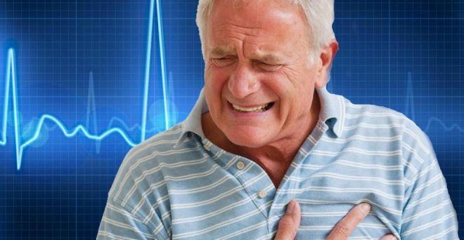 смерть от инфаркта смерть от инфаркта