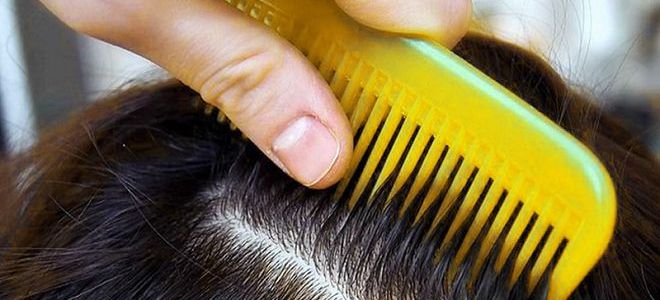 к чему снятся вши во сне